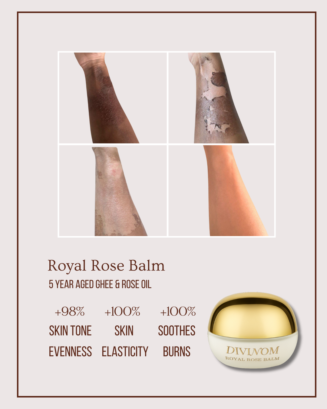 Royal Rose Balm