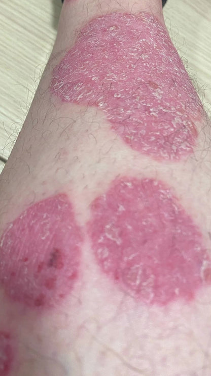 Advanced Skin Healing Set